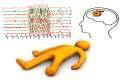 התקף פרכוסי ואפילפסיה