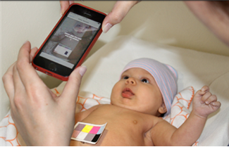 חדש: אפליקציה לזיהוי צהבת תינוקות בטלפון הנייד