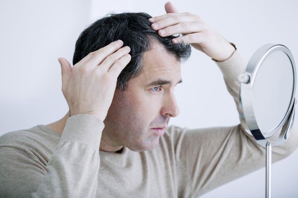 קשה לדעת כיצד גורם ספציפי משפיע על אובדן השיער