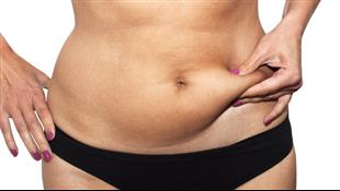 6 דברים שאתם חייבים לדעת על שאיבת שומן