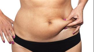 6 דברים שאתם חייבים לדעת על שאיבת שומן