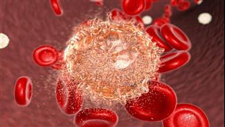 לוקמיה (סרטן הדם): כל הסוגים, הגורמים, ודרכי הטיפול