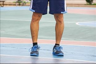 רגליים עקומות במתבגרים: מצב חולף או בעיה שדורשת טיפול?