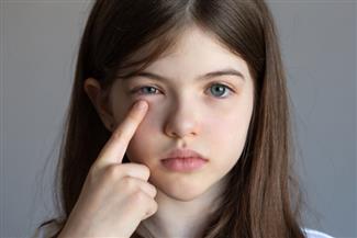 לא רק נזלת אלרגית: הכירו את דלקת העיניים העונתית שנפוצה בעיקר בילדים