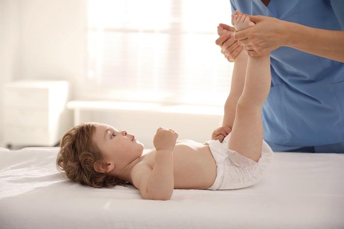 רופא אורתופד בודק את כפות הרגליים של התינוק כדי לשלול חשד למומים בכפות הרגליים