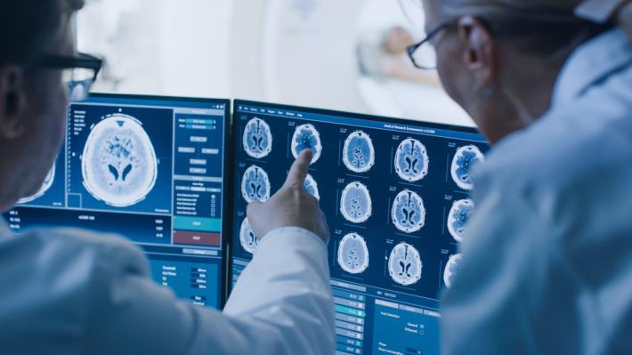 רדיולוגיה מפענח בדיקת MRI לצורך חוות דעת רפואית שניה