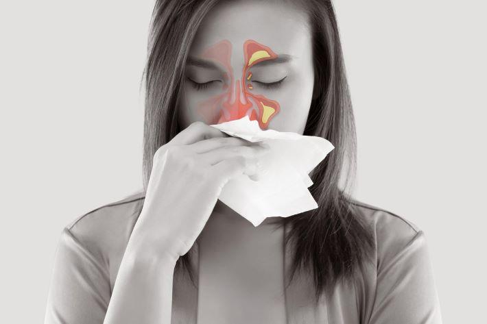 בחורה שסובלת מסינוסיטיס מקנחת את האף
