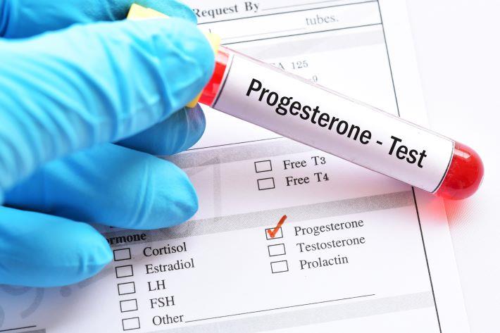 מבחנה עם בדיקת דם לערכי פרוגסטרון