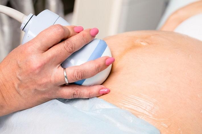 יד של רופאה אוחזת במתמר אולטרסאונד על בטן של אישה בהיריון בזמן סקירת מערכות מאוחרת