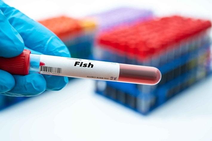 יד אוחזת במבחנת דם של בדיקת FISH