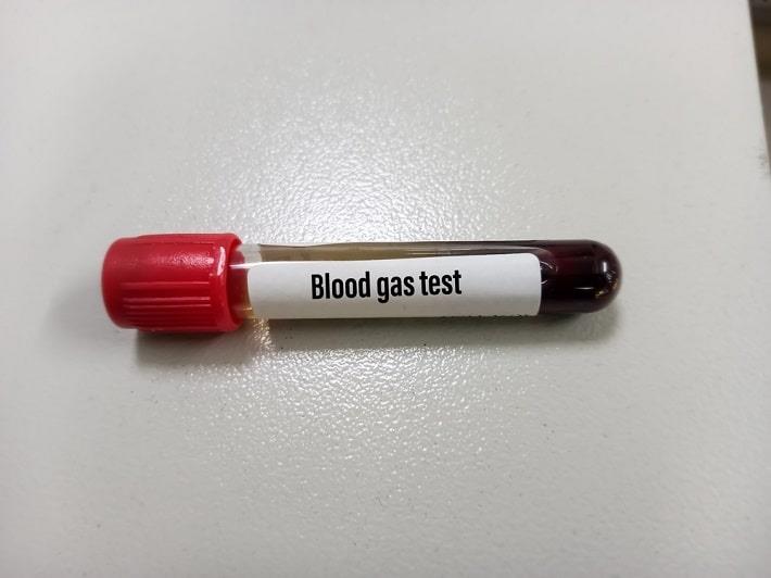 מבחנה מלאה בדם ועליה הכיתוב בדיקת גזים בדם ורידי באנגלית, Blood Gases Test