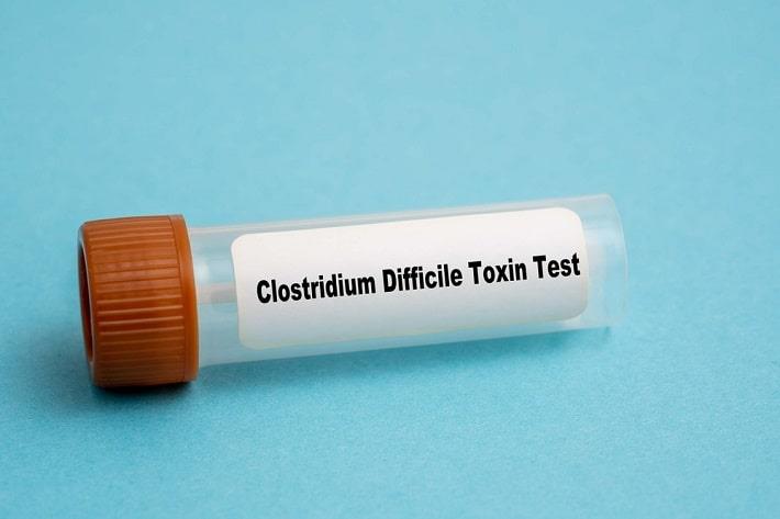 מבחנה לבדיקת צואה של קלוסטרידיום טוקסין 