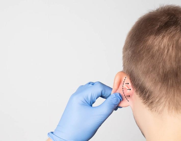 בדיקת גב אוזן של ילד לפני ניתוח הצמדת אוזניים