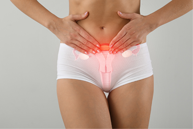 איור של מערכת הרבייה הנשית על גופה של אישה, מסמל את תחום הגניקולוגיה