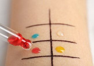 אלרגיות נוספות