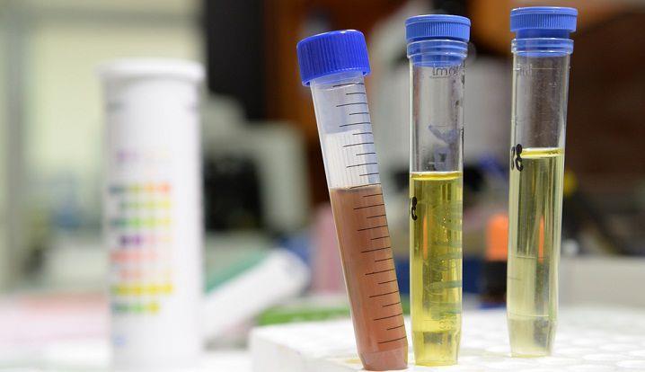 פענוח בדיקות שתן