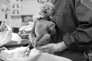 מה עושים כשהלידה לא מתקדמת?