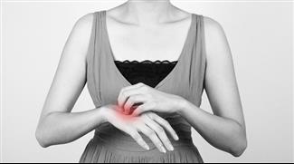 אקזמה בידיים