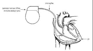 קוצב לב - המדריך המלא