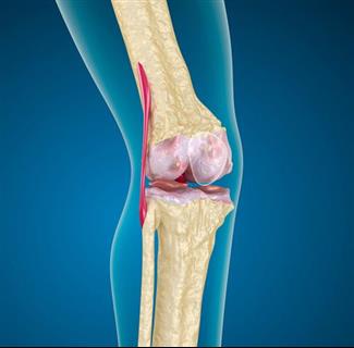 זוהה גורם חדש לשחיקת סחוס