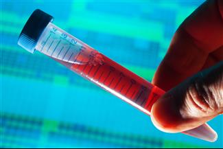 "תרומות דם מהומוסקסואלים יצילו מיליוני אנשים"