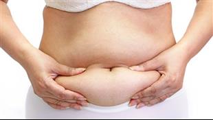 מתיחת בטן או שאיבת שומן: כך תדעו מה מתאים לכם יותר