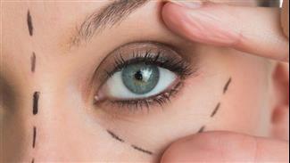 המדריך המלא: מה אתם חייבים לבדוק לפני ניתוח פלסטי