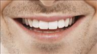 מינימום כאב מקסימום תוצאות: הכל על השתלות שיניים ממוחשבות