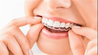 כך תשיגו חיוך מושלם: טיפולי אורתודונטיה משולבים עם ציפוי שיניים