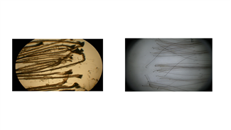 מהן בעיות השיער הנפוצות וכיצד ניתן לאבחן?