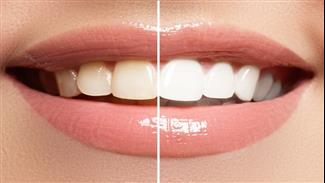 6 דרכים טבעיות להלבין שיניים