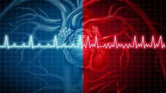 הפרעת קצב לב מעלה את הסיכון לדמנציה