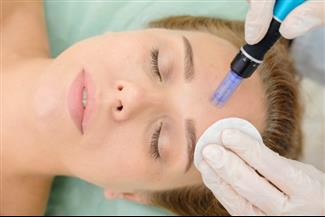 הצערת הפנים ללא ניתוח: מהי שיטת המזותרפיה?