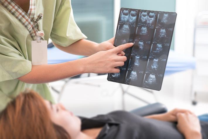 רופאה מ סבירה לאישה על ממצאי אולטרסאונד מוח של העובר