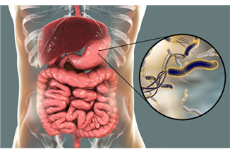 טיפול טבעי בקנדידה במעיים | Infomed
