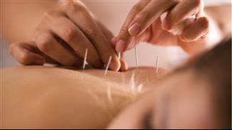 דיקור לדיכאון: האם זה עובד?