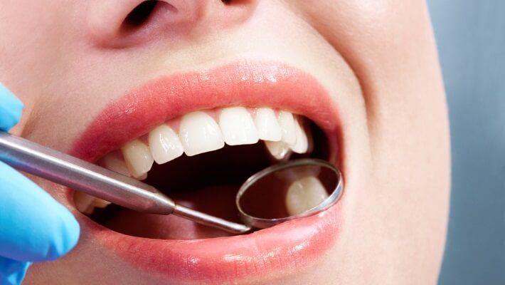 עקירת שיניים כירורגית