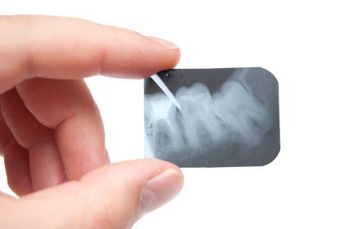 טיפולי שיניים בטיפול בזמן