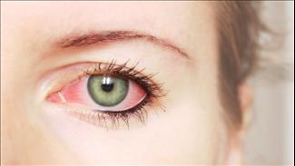 עיניים: 9 סימנים שאסור להתעלם מהם