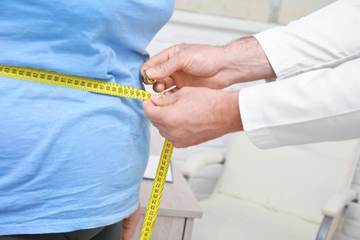 רופא מודד את היקפיו של אדם לאחר ניתוח לירידה במשקל