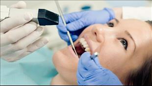 הסוף לתפרים: כל המידע על השתלות שיניים ממוחשבות