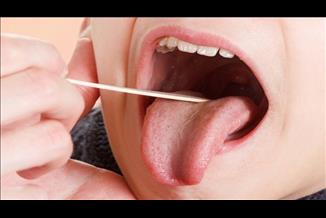 ניתוח להסרת שקדים: מתי מתבצע ומהם הסיכונים?