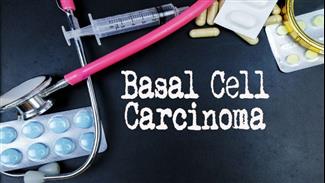 טיפול חדשני לסרטן העור מסוג קרצינומת תאי הבסיס (BCC)