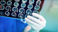 תאי מוח העצם יכולים לעזור בטיפול בשבץ מוחי