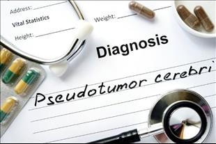 תסמונת פסוידוטומור צרברי : מהם התסמינים שיעוררו חשד ואיך מאבחנים?