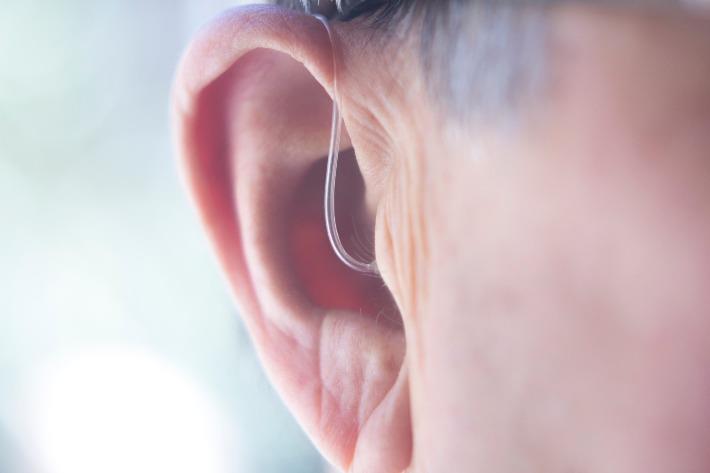 מכשיר שמיעה באוזנו של אדם לצורך שיקום שמיעה בעקבות ליקוי חד צדדי