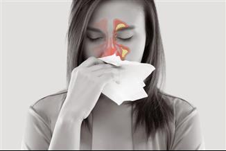 סינוסיטיס כרונית: באיזה מצבים יוחלט על ניתוח?