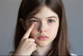 לא רק נזלת אלרגית: הכירו את דלקת העיניים העונתית שנפוצה בעיקר בילדים