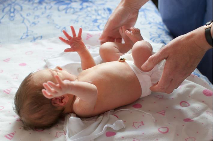 רופא בוחן תינוק בגלל חשד לבקע מפשעתי 
