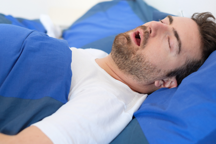 אדם ישן עם פה פתוח כי סובל מדום נשימה בשינה 